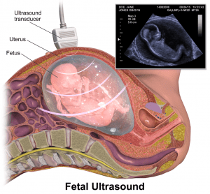 1024px Fetal Ultrasound
