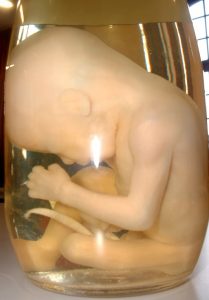 Human Fetus2