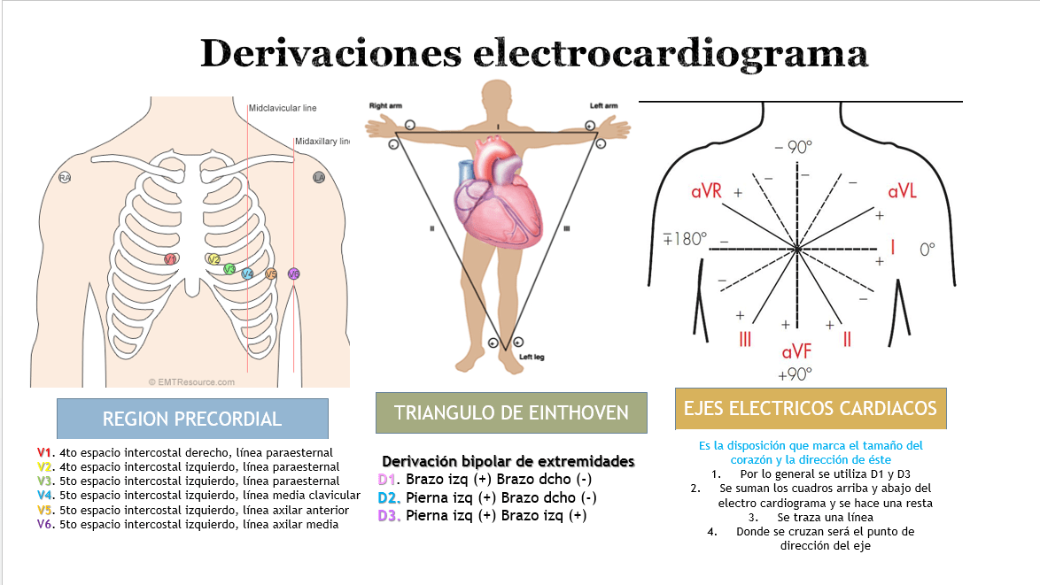 ¿Cómo se colocan los Electrodos del Electrocardiograma?