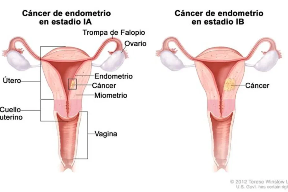 El cáncer según la ubicación en el cuerpo Parte 3