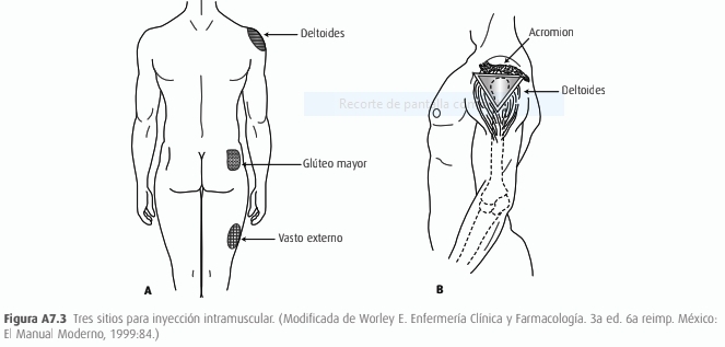 3 sitios de inyeccion intramuscular