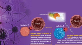 Inmunoterapia para tratar el cáncer