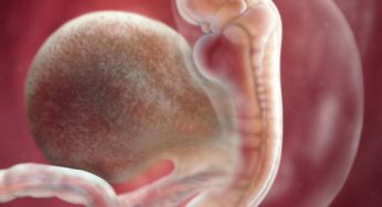 Desarrollo Fetal Temprano – Semana 5 (Edad fetal: Semana 3)