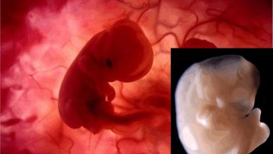 Desarrollo Fetal Temprano. Semana 6 (Edad Fetal: 4 Semanas)