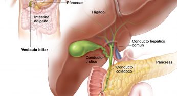 Clasificación celular del cáncer de vesícula biliar