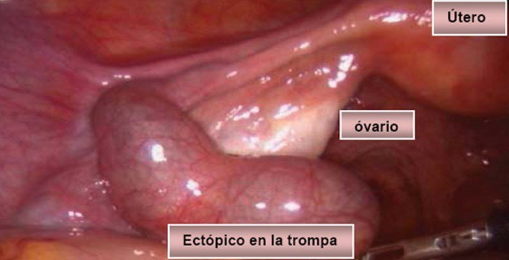 El desarrollo fetal