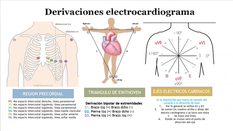 ¿cómo Se Colocan Los Electrodos Del Electrocardiogramaemk 3812