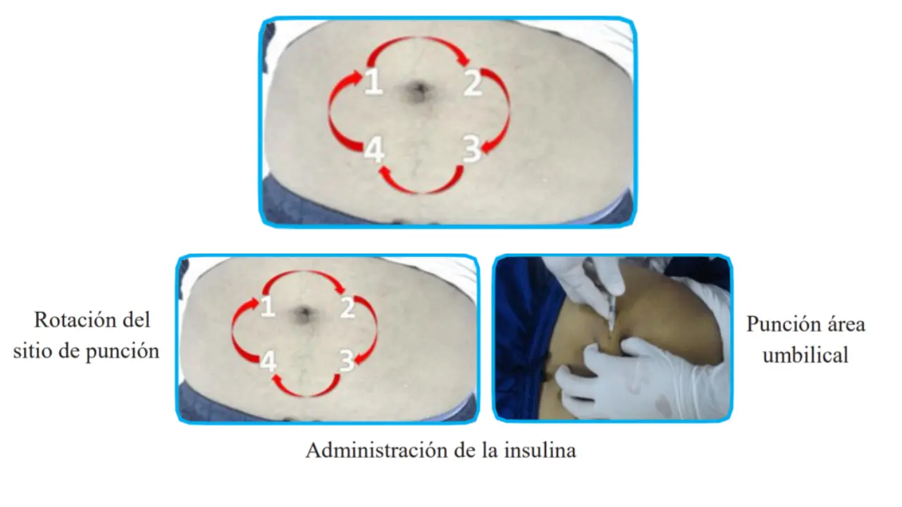 Maestría en Farmacología: Vía Subcutánea