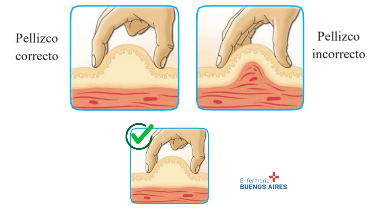 Pinzamiento correcto - Maestría en Farmacología: Vía Subcutánea