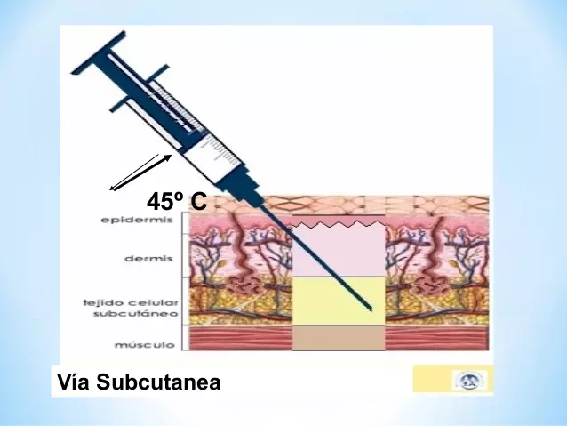 Ángulo 45 grados, pasando la dermis y antes de llegar al músculo. - Maestría en Farmacología: Vía Subcutánea