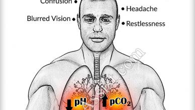 acidosis respiratoria 1