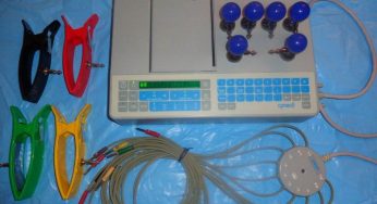 ¿Qué elementos se utilizan en un Electrocardiograma?