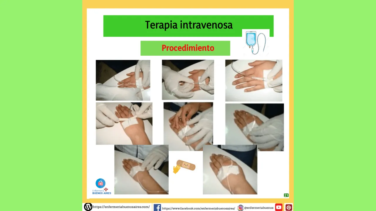 Procedimiento sobre Terapia Intravenosa