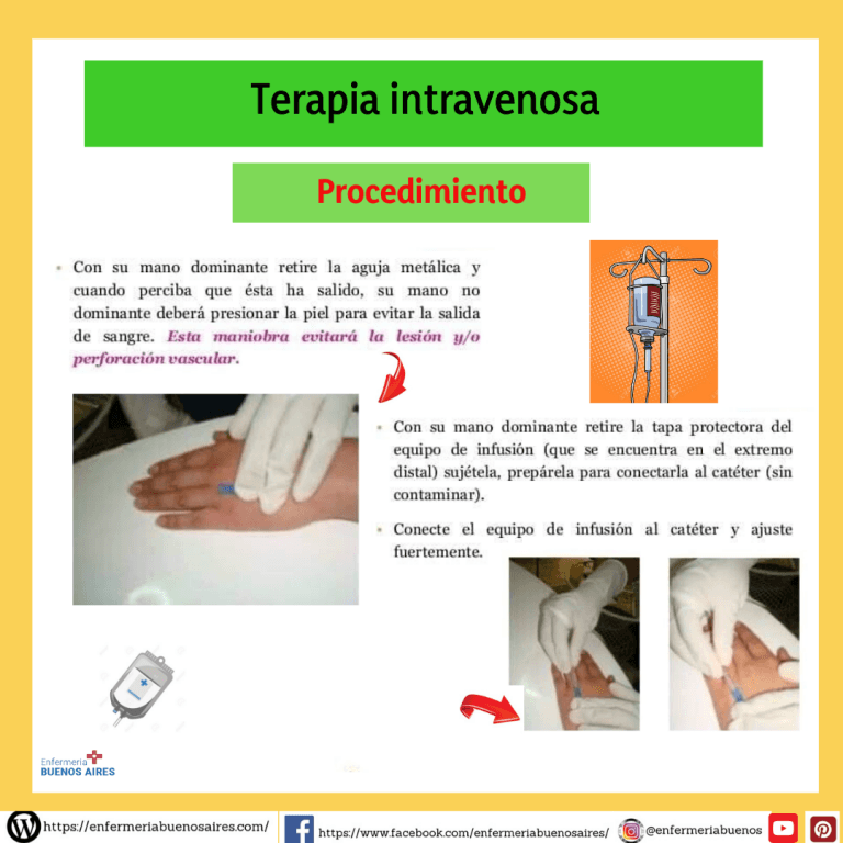 Procedimiento Sobre Terapia Intravenosa Infografias Completas 2022 8583