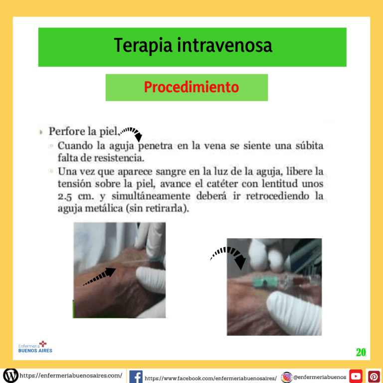 Procedimiento Sobre Terapia Intravenosa Infografias Completas 2022 1666