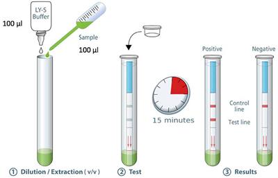 Procedimiento del Test SARG-CoV-2 - Infografía