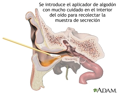 Cultivo de punción timpánica