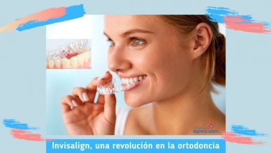 Invisalign - Una revolución en la ortodoncia