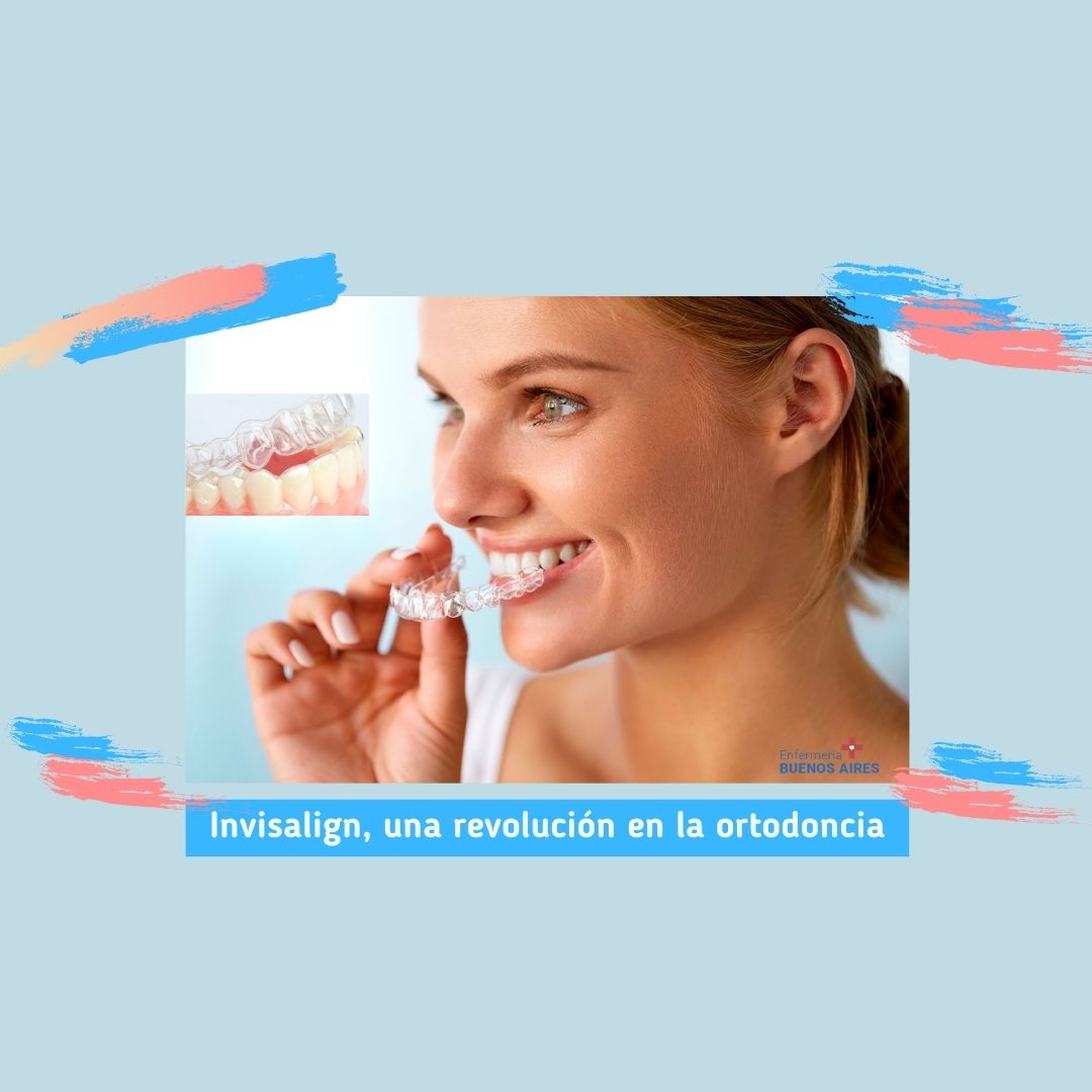 Invisalign - Una revolución en la ortodoncia