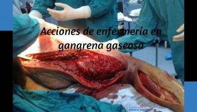 Gangrena gaseosa 1
