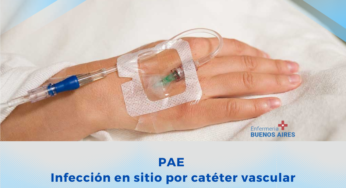 PAE – Infección del sitio catéter vascular