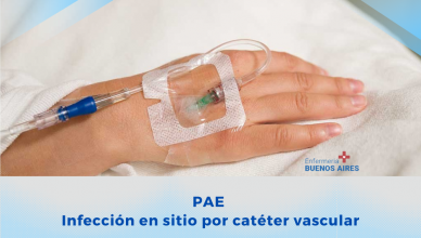 PAE – Infección del sitio catéter vascular