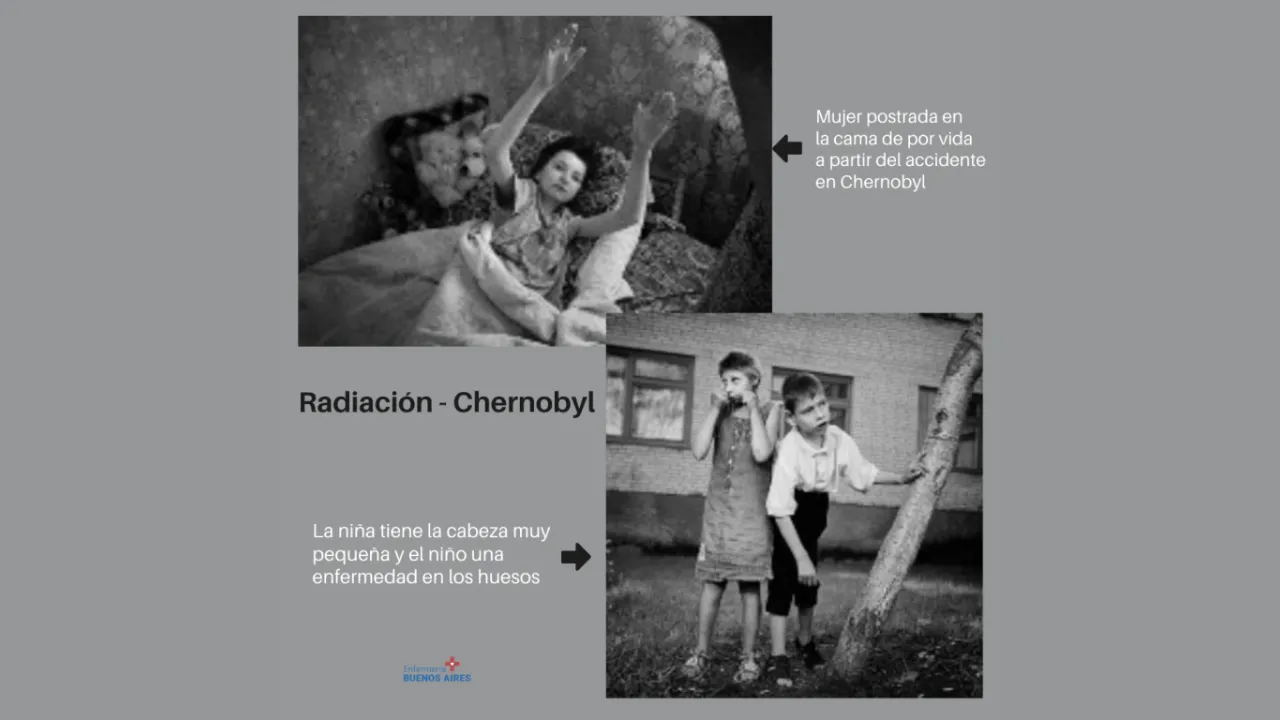 Imagen 4- ¿Qué efectos produce la radiación nuclear en el cuerpo?