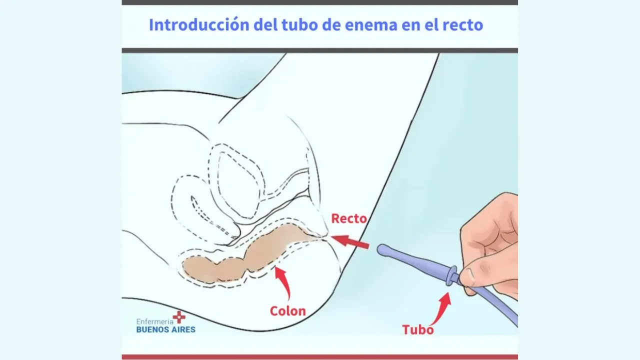 Cuánto jabón coloco para preparar una enema - 2024