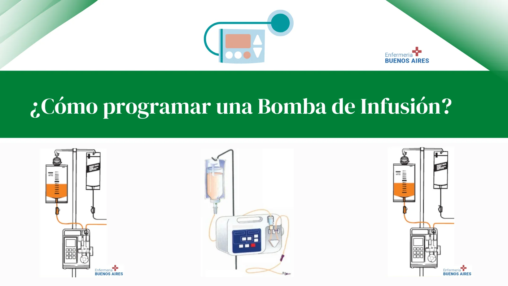 ¿Cómo programar una bomba de infusión?