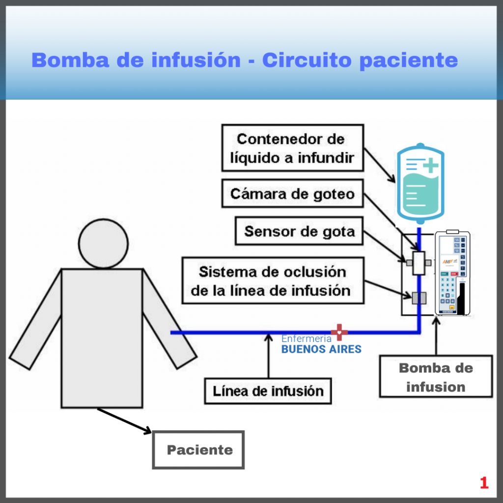 Cómo Programar Una Bomba De Infusión - 2024