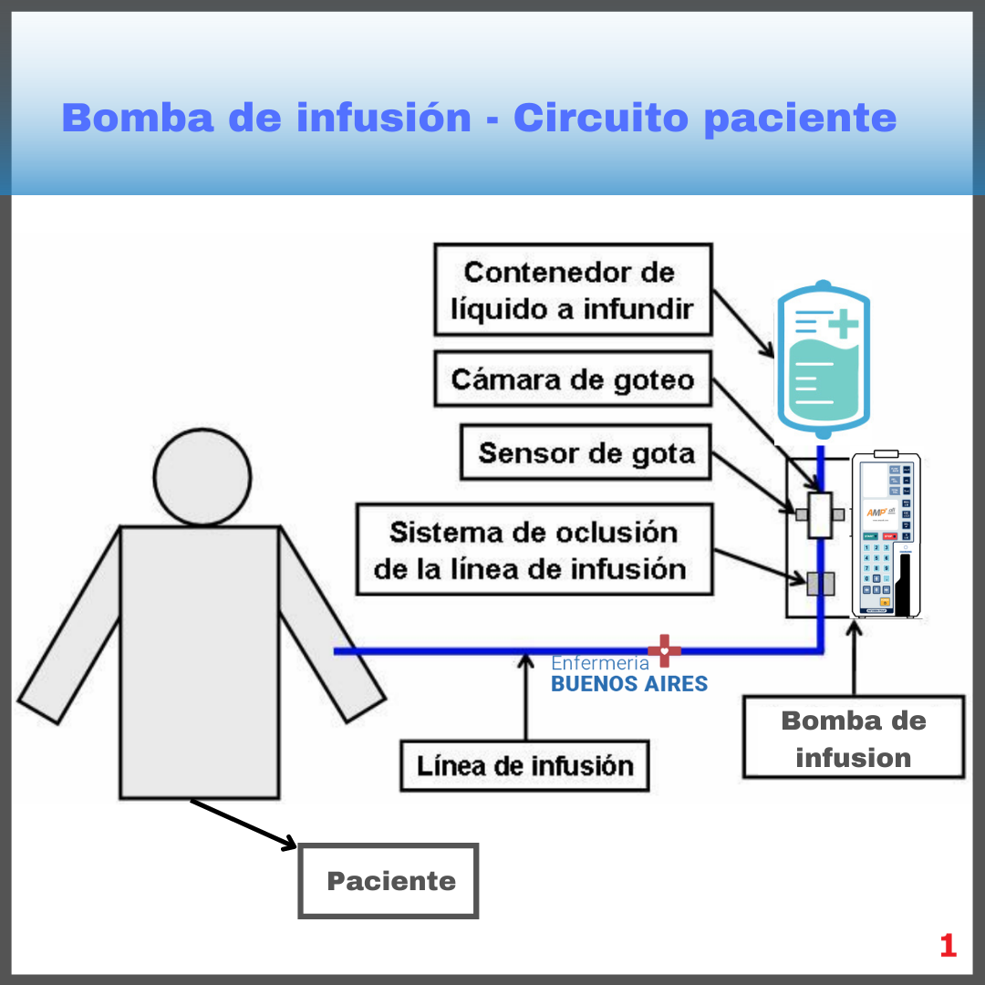 ¿Cómo programar una bomba de infusión?