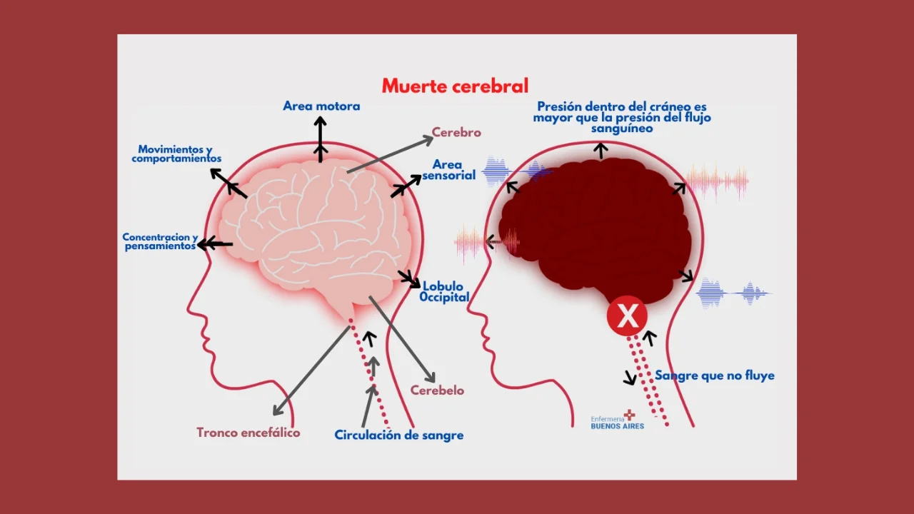 Diferencia entre Muerte Cerebral