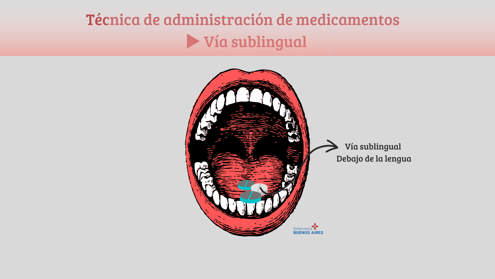 Vía sublingual - Administración de fármacos
