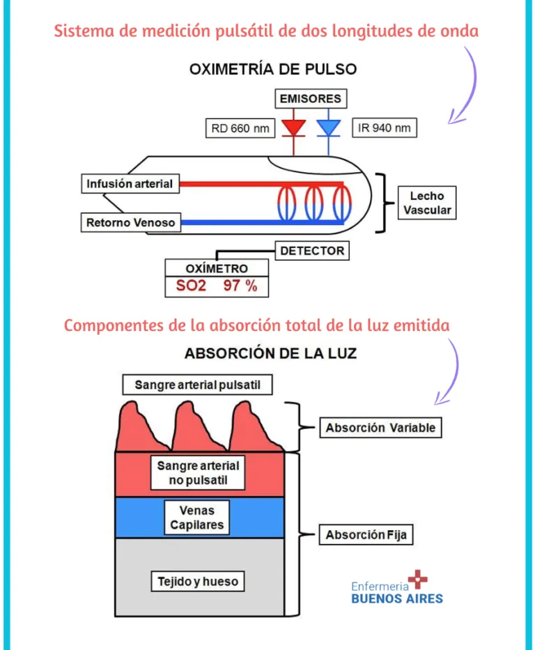 Sistema de medición pulsátil - Imagen 6