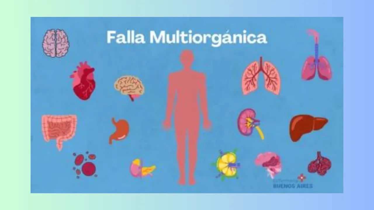 Falla multiorgánica