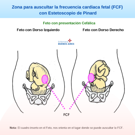 Cómo usar el fonendoscopio para embarazadas para escuchar el feto?