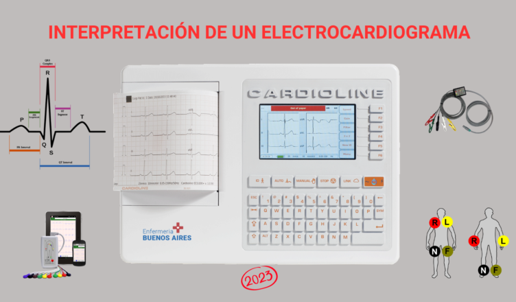 Interpretación de un Electrocardiograma