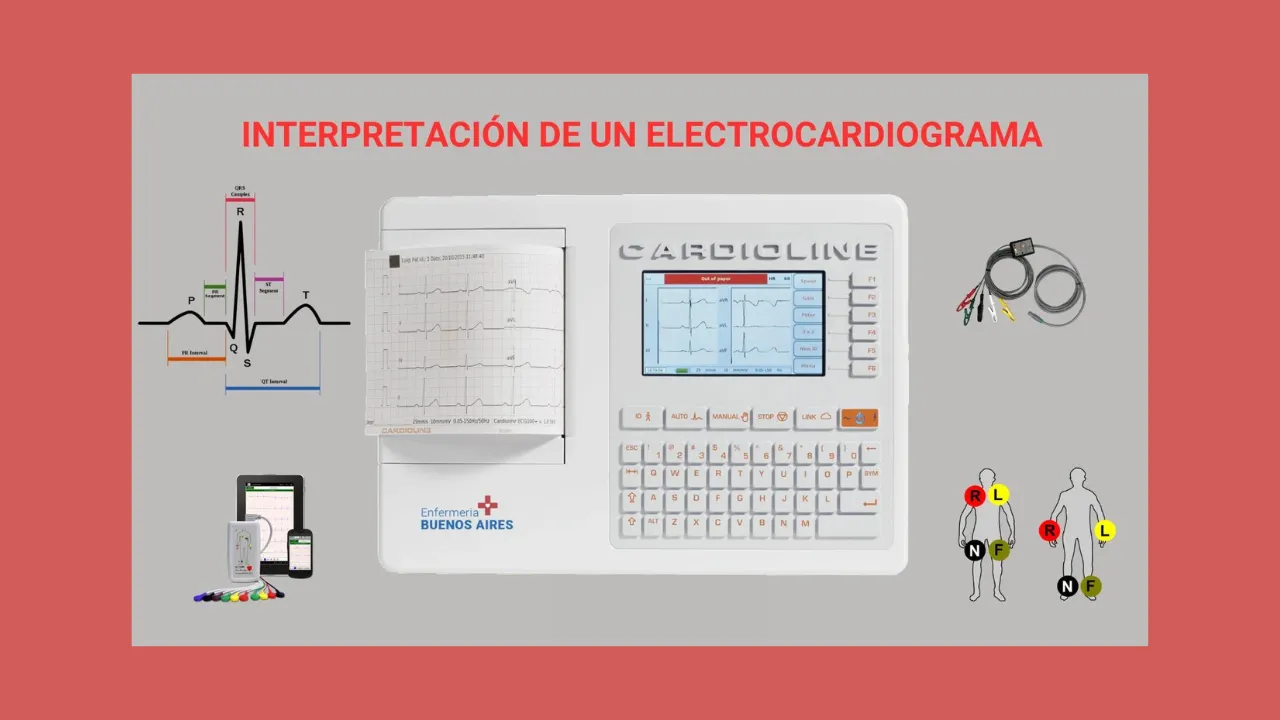 Interpretación de un Electrocardiograma