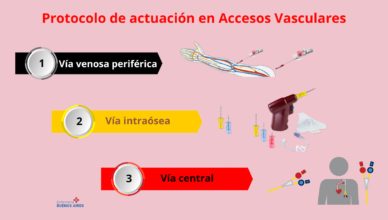 Priorización de los accesos vasculares