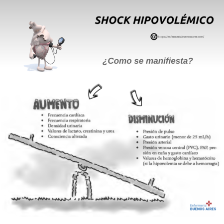 Shock cardiogénico y shock hipovolémico