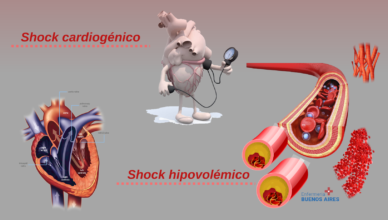 shock cardiogenico y
