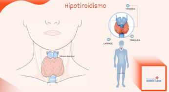 Hipotiroidismo – Tratamiento y seguimiento