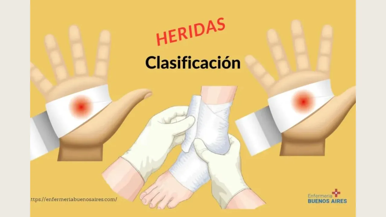 Clasificación de las heridas