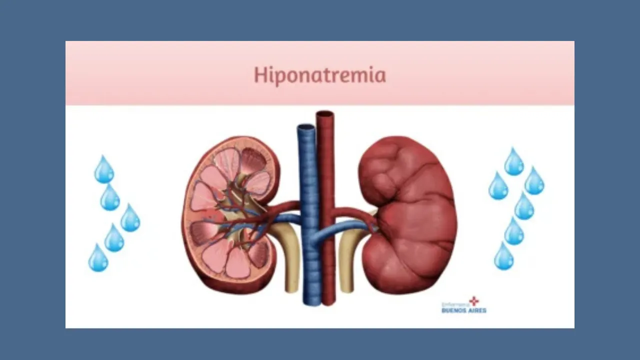 Hiponatremia