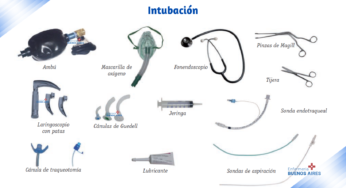 Intubación – Medicina de emergencia y anestesia