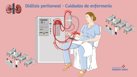 Diálisis peritoneal - Cuidados de enfermería