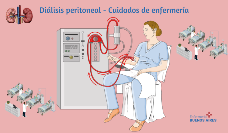Diálisis peritoneal - Cuidados de enfermería