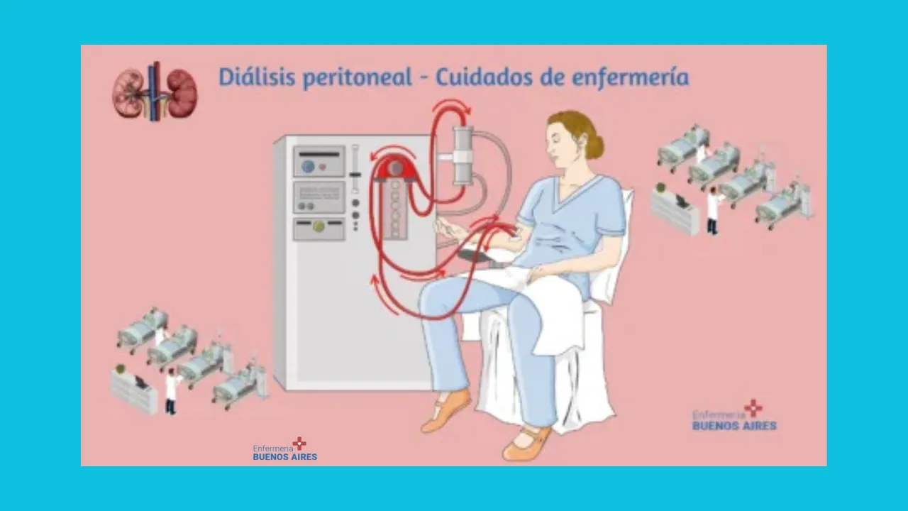 Diálisis peritoneal 