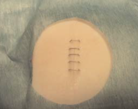 ¿Cuáles son los 7 tipos de sutura?