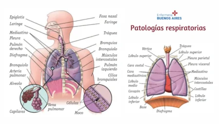 Patologías respiratorias más frecuentes